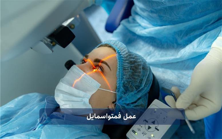 رهایی از عینک با فمتواسمایل: راهکاری پیشرفته برای دنیای شفاف