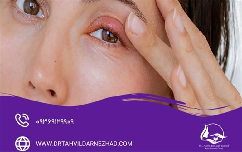 وقتی جراحی زیبایی پلک نتیجه مطلوب نمی‌دهد؛ مهم‌ترین عوارض بلفاروپلاستی چیست؟