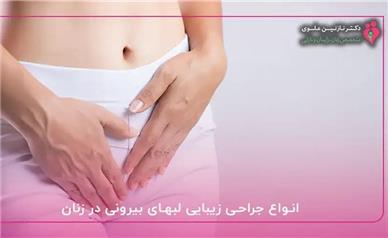 معیارهای طلایی برای پیشگیری از عوارض لابیاپلاستی