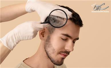 کمبود کدام ویتامین باعث نازک شدن مو می‌شود؟