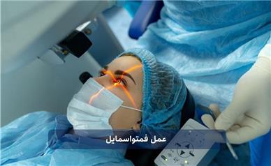 رهایی از عینک با فمتواسمایل: راهکاری پیشرفته برای دنیای شفاف