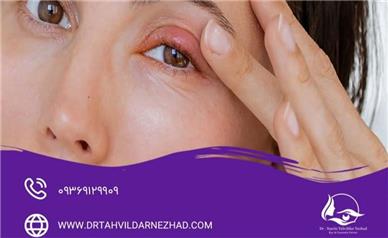 وقتی جراحی زیبایی پلک نتیجه مطلوب نمی‌دهد؛ مهم‌ترین عوارض بلفاروپلاستی چیست؟