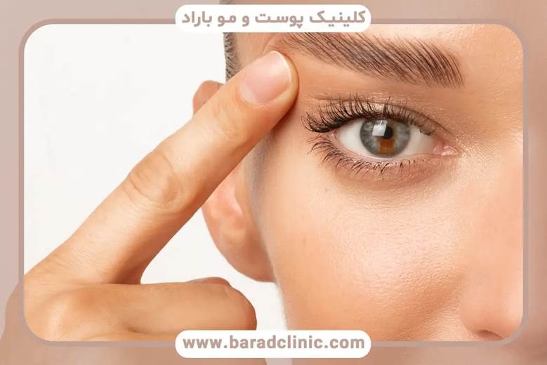 مشاوره اولیه و بررسی سلامت پلک‌ها