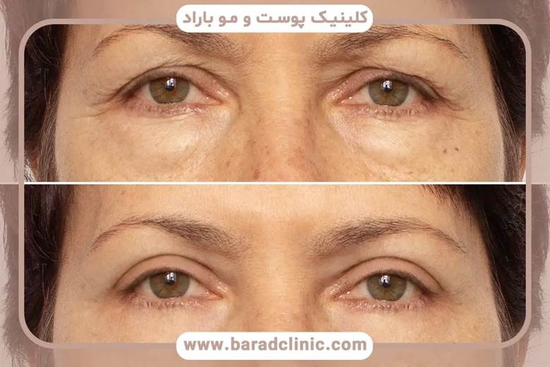 مراقبت‌های بعد از عمل و مدیریت درد