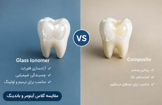 مقایسه گلاس آینومر و کامپوزیت دندانپزشکی
